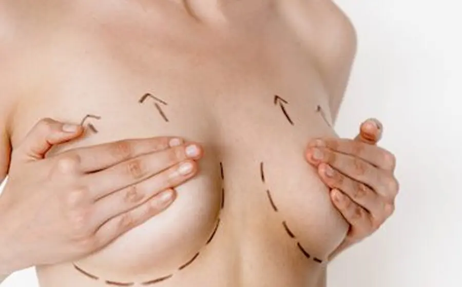 Breast Reduction / Reduction Mammoplasty
