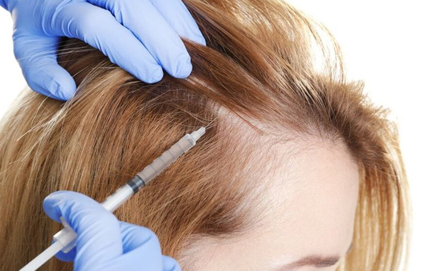 Follicular Unit Extraction (FUE) Hair Transplantation